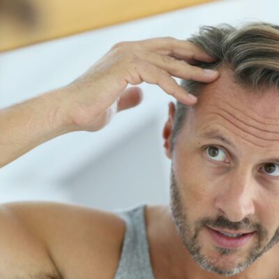 Successful Hair Loss Treatments